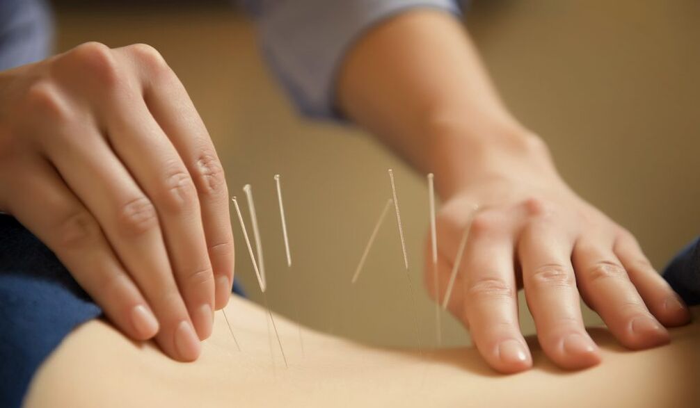 Acupuncture is a common method for treating chronic prostatitis
